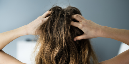 Minister reverses decision to cut life-changing support for hair loss patients
