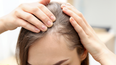 Pharmacist explains how poor sleep can lead to hair loss