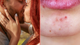 Expert issues grim warning to anyone who kisses bearded men