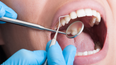 Lab-grown teeth could become an alternative for fillings in humans