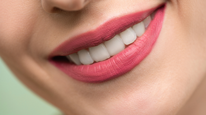 Shoppers are raving about the teeth whitening kit that gives ‘instant results’