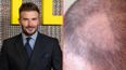 David Beckham left with ‘terrible’ bald patch after trying to cut his own hair