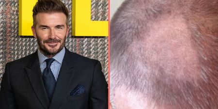 David Beckham left with ‘terrible’ bald patch after trying to cut his own hair