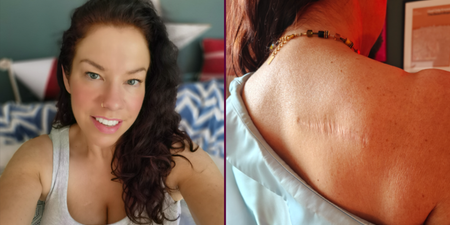 ‘I used sunbeds to get a tan to look healthy but, ironically, I’m far from healthy now’
