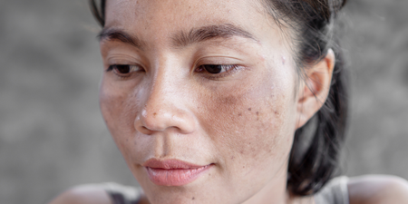 Why you need to wear SPF on your lips, according to a skincare expert