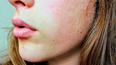 'A little goes a long way' - The moisturiser people with dry skin won't regret buying this winter