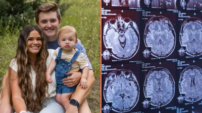 Woman marries man who forgot about their breakup after concussion